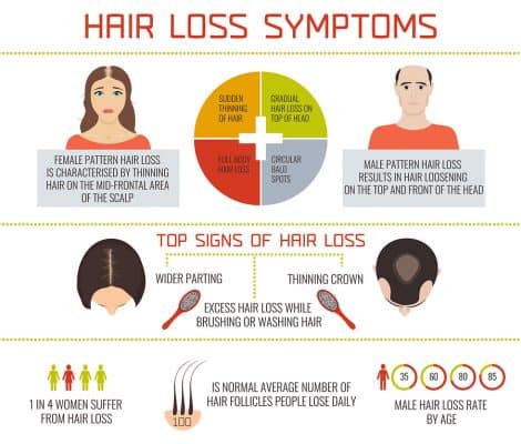 Hair-Loss-Symptoms-470x400-1